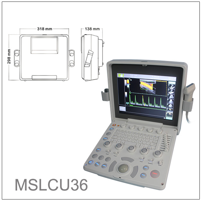 MSLU 36